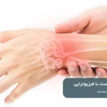 درمان درد مچ دست با فیزیوتراپی