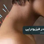 طب سوزنی در فیزیوتراپی