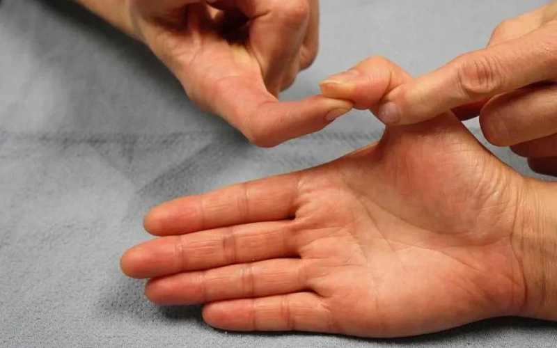 راه‌های درمان پارگی تاندون دست