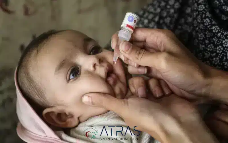 واکسن فلج اطفال خوراکی