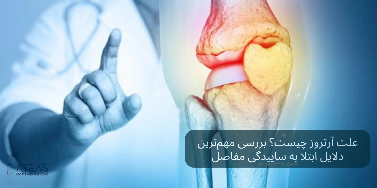 علت آرتروز چیست؟ بررسی مهم‌ترین دلایل ابتلا به ساییدگی مفاصل