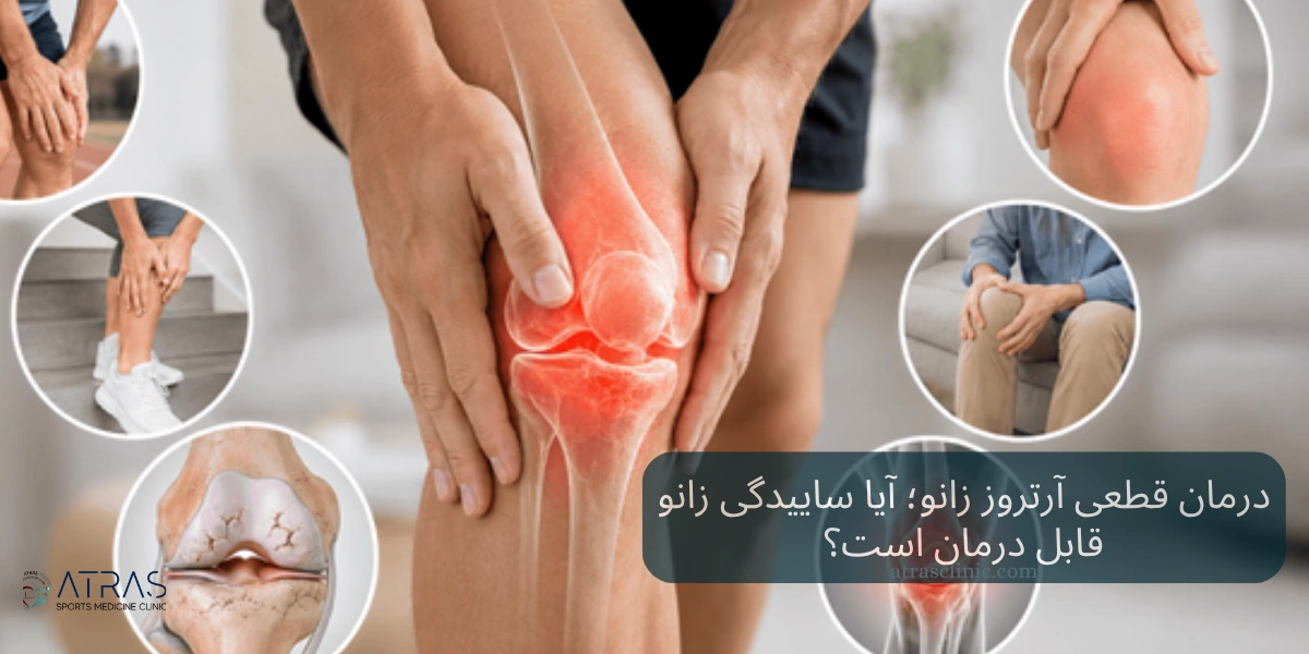 درمان قطعی آرتروز زانو؛ آیا ساییدگی زانو قابل درمان است؟