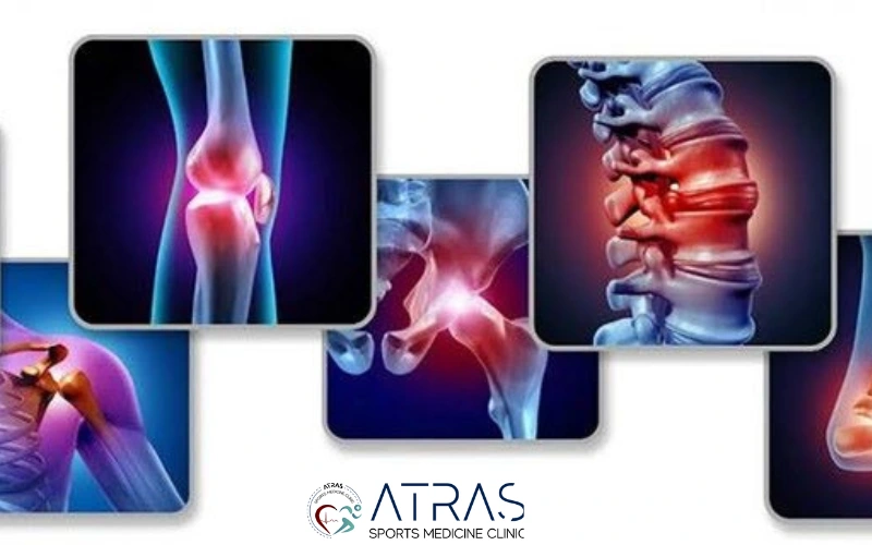 علت آرتروز چیست؟ بررسی مهم‌ترین دلایل ابتلا به ساییدگی مفاصل 