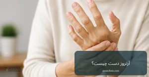 آرتروز دست و روش درمان
