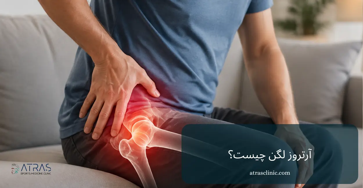 آرتروز لگن چیست؟ بررسی علائم