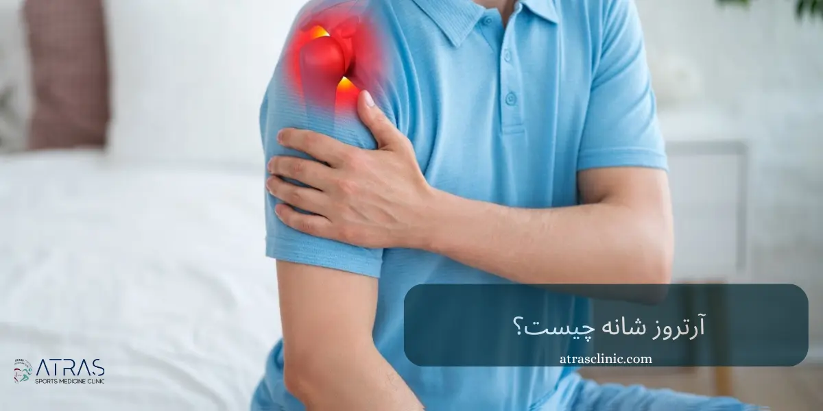 آرتروز شانه