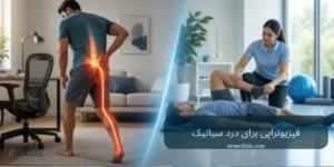 فیزیوتراپی سیاتیک ناشی از دیسک کمر